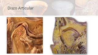 Teórico  Articulaciones y ATM  Anatomía [upl. by Labotsirhc]