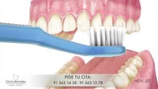 Limpieza dental  Recomendaciones [upl. by Hector636]