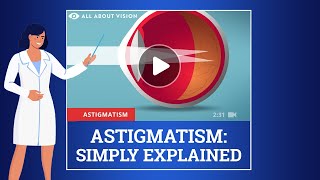 What Is Astigmatism and What Are the Symptoms [upl. by Layap]