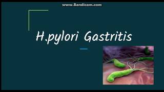 What is a H Pylori Helicobacter Pylori Infection [upl. by Gillette]