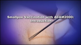 Chapter 1 Smallpox Vaccination with ACAM2000 Introduction [upl. by Oetam]