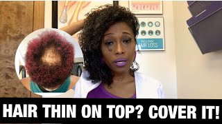 Natural Hairstyles for THINNING Crown [upl. by Anialam819]