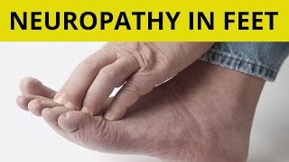 Peripheral Neuropathy Isnt Permanent Reverse Painful Symptoms with Treatment [upl. by Perce752]