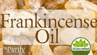 Frankincense Essential Oil  All You Need To Know [upl. by Heiskell]