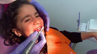 Limpieza Dental Infantil [upl. by Kyla678]