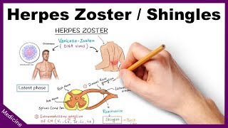 Herpes ZosterShingles Symptoms Diagnosis Treatment [upl. by Reahard]