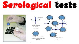 Serology Basics Hepatitis C Testing [upl. by Irpac]