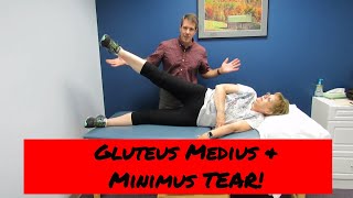 Gluteus Medius and Minimus tear vs Greater Trochateric Bursitis [upl. by Alleoj]