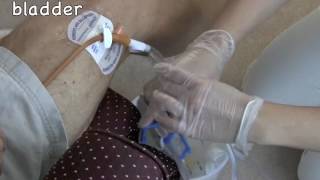 Nurses Notes 101 Urinary Catheter Care [upl. by Kristen]