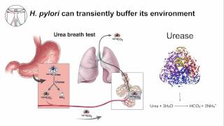 H pylori  From Diagnosis to Therapeutics [upl. by Sirtimid]