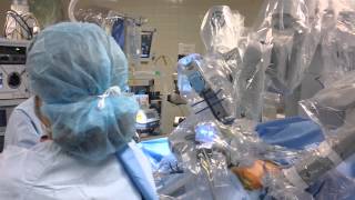 daVinci® SingleSite® Gallbladder Surgery  Middlesex Hospital [upl. by Ahs]