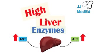 High Liver Enzymes  Aspartate vs Alanine Aminotransferase AST vs ALT  Causes [upl. by Yednarb509]