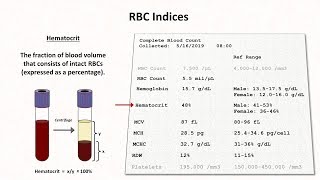 How to Interpret RBC Indices eg hemoglobin vs hematocrit MCV RDW [upl. by Uhayile924]