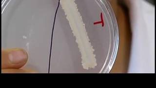 Lipase test Lipid hydrolysis assay [upl. by Rheingold565]