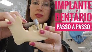 Implante Dentário Passo a Passo l Dra Danielle Sales [upl. by Kenison205]