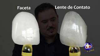 Facetas e Lentes de Contato Dentais qual a diferença [upl. by Joon]