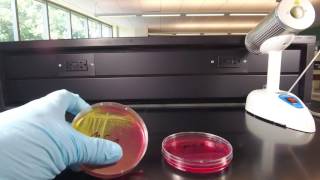 Mannitol salts agar [upl. by Aital]