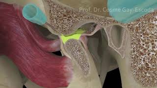 Patología Disfuncional de la ATM  PerioPixel [upl. by Marta]