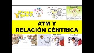 quotATM Y RELACIÓN CÉNTRICAquot por el Dr Henry Vicente [upl. by Trebleda]