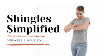 Shingles Simplified [upl. by Nnylecoj]