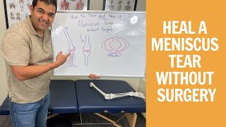 How To Test amp Heal A Meniscus Tear Without Surgery [upl. by Eimac]